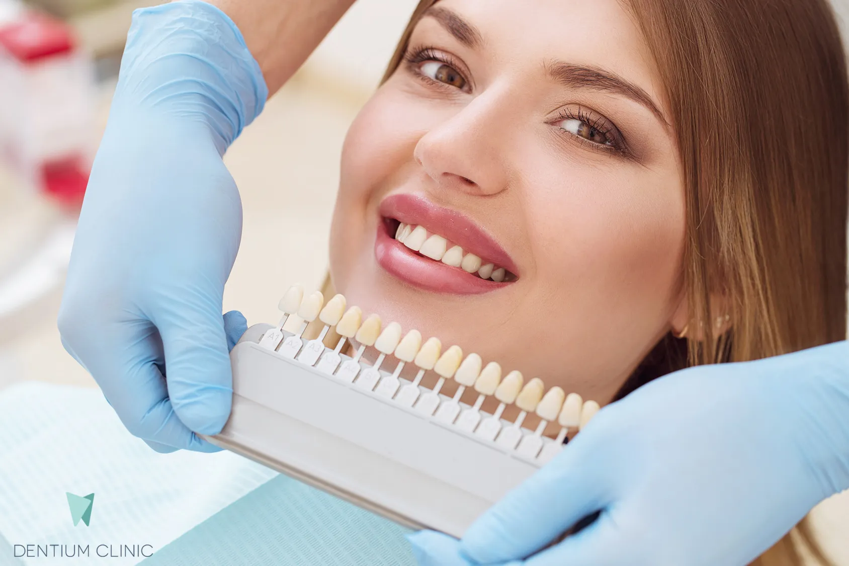 Wybielanie zębów – podstawowe informacje, które warto wiedzieć przed zabiegiem