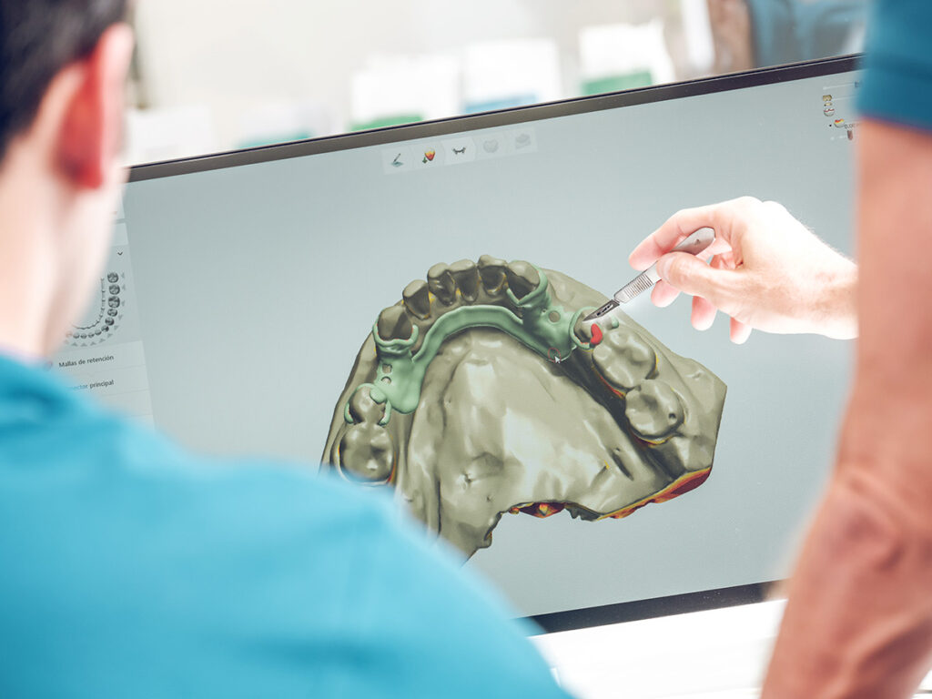 Dynamiczna nawigacja komputerowa – nowoczesne podejście do pięknego uśmiechu Dynamiczna nawigacja komputerowa – nowoczesne podejście do pięknego uśmiechu