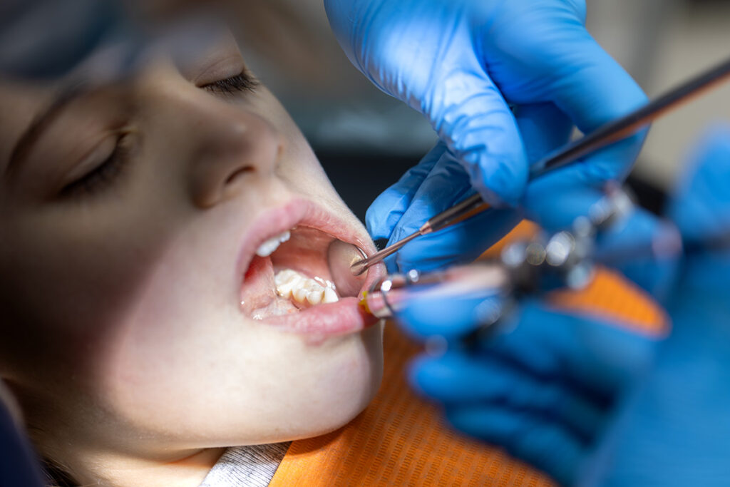 Wyrwanie zęba i odbudowa jeszcze tego samego dnia? To możliwe. Wyjaśniamy, na czym polega implantacja natychmiastowa